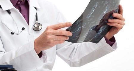 orthopédie